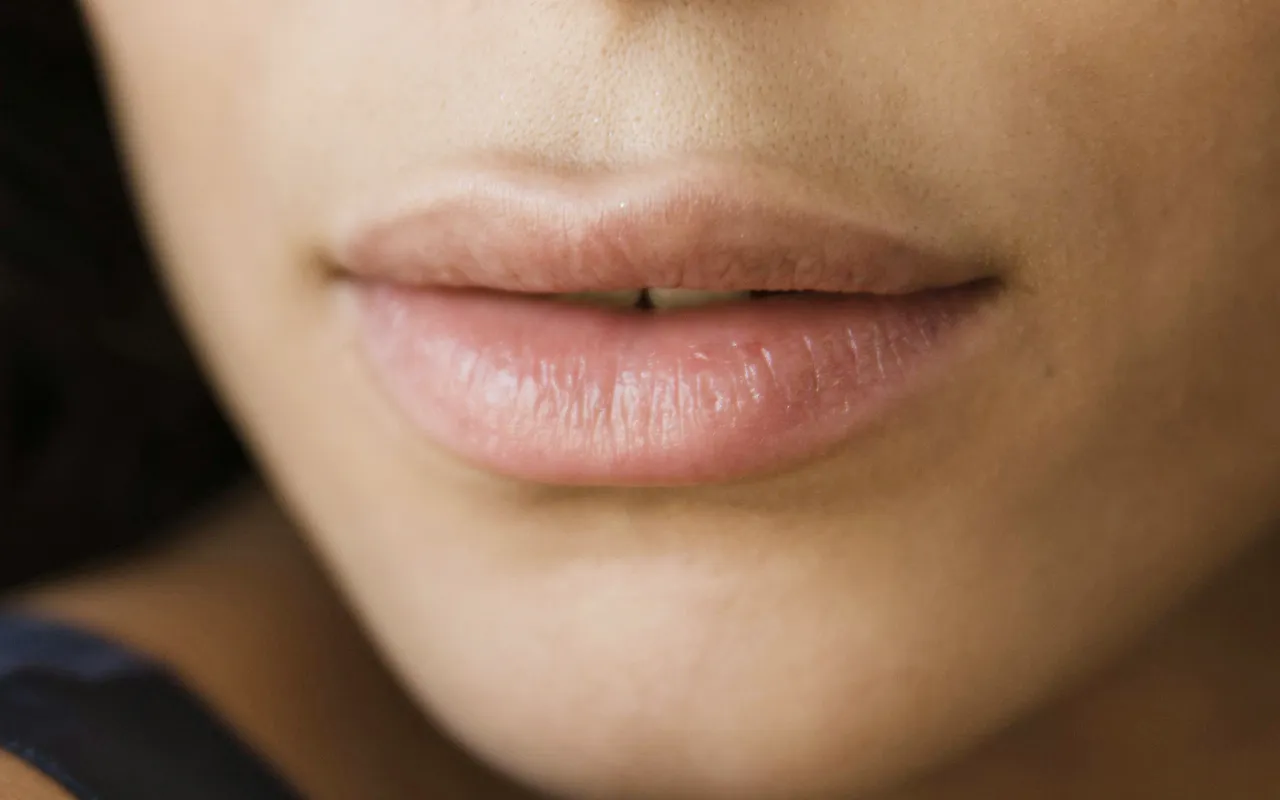 aumento de labios en Alicante con ácido hialurónico en Gutiérrez Clinic por el Doctor Enrique Gutiérrez