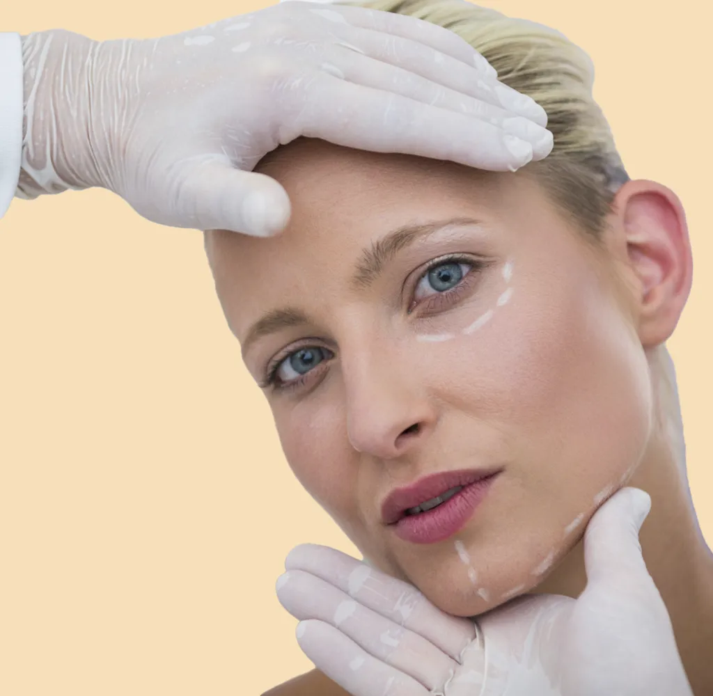 beneficios del Endolift facial