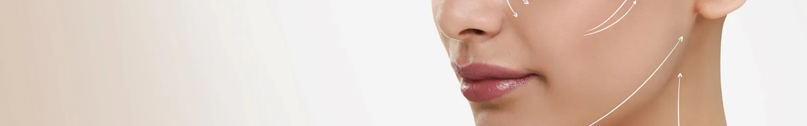 endolift efectos secundarios