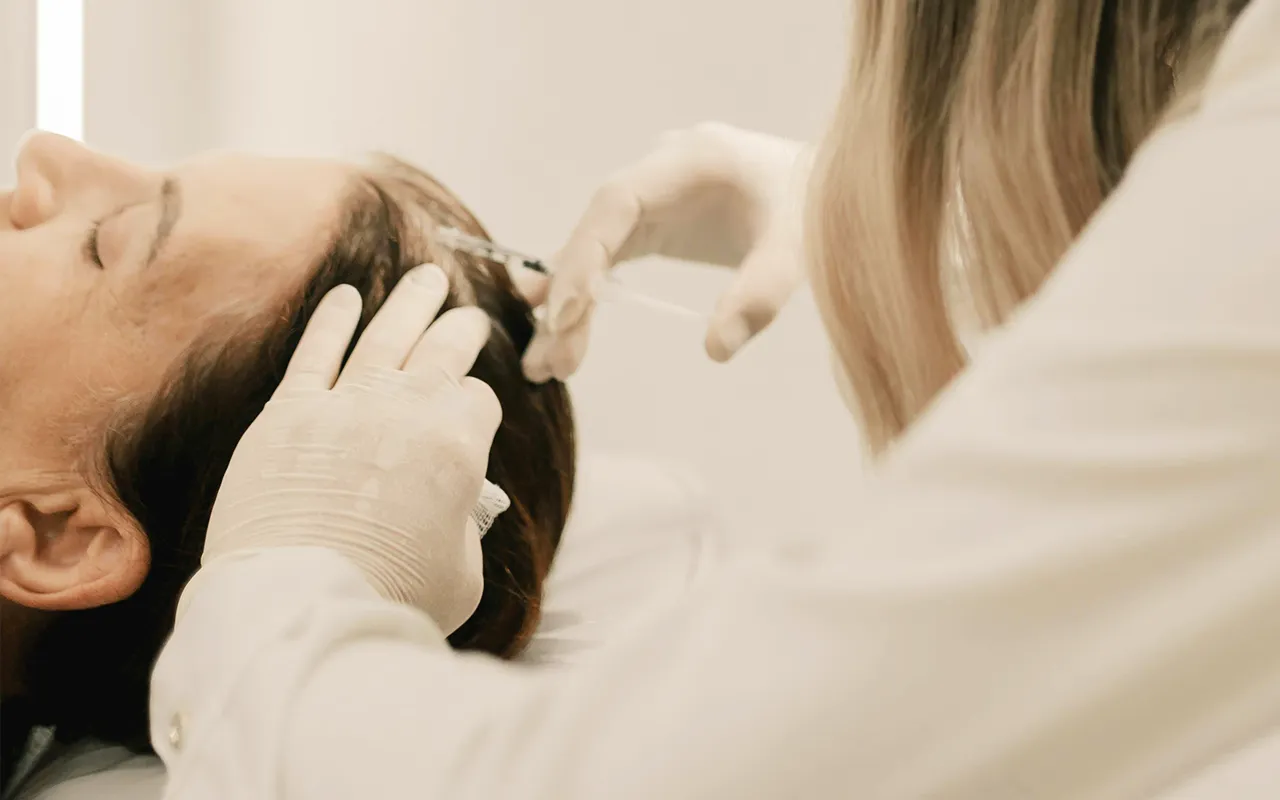 PRP capilar en Alicante tratamiento con plasma rico en plaquetas en Gutiérrez Clinic