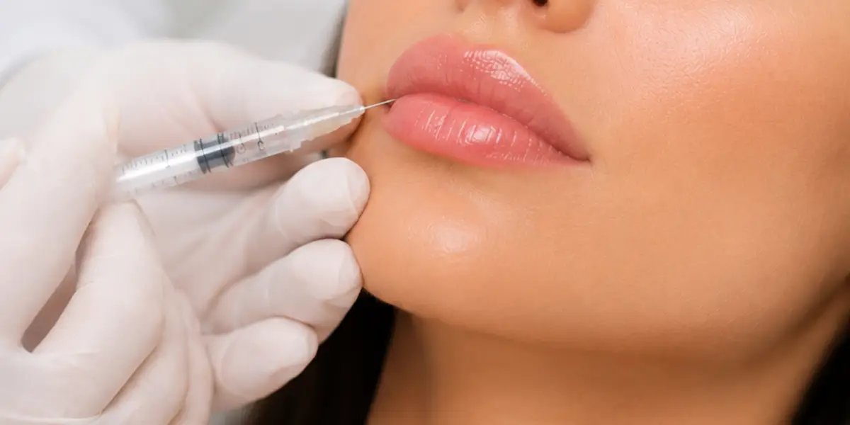 Hidratación de labios con ácido hialurónico en Alicante para mejorar la elasticidad, luminosidad y calidad del tejido labial.